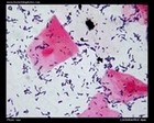 lactobacilli in vagina